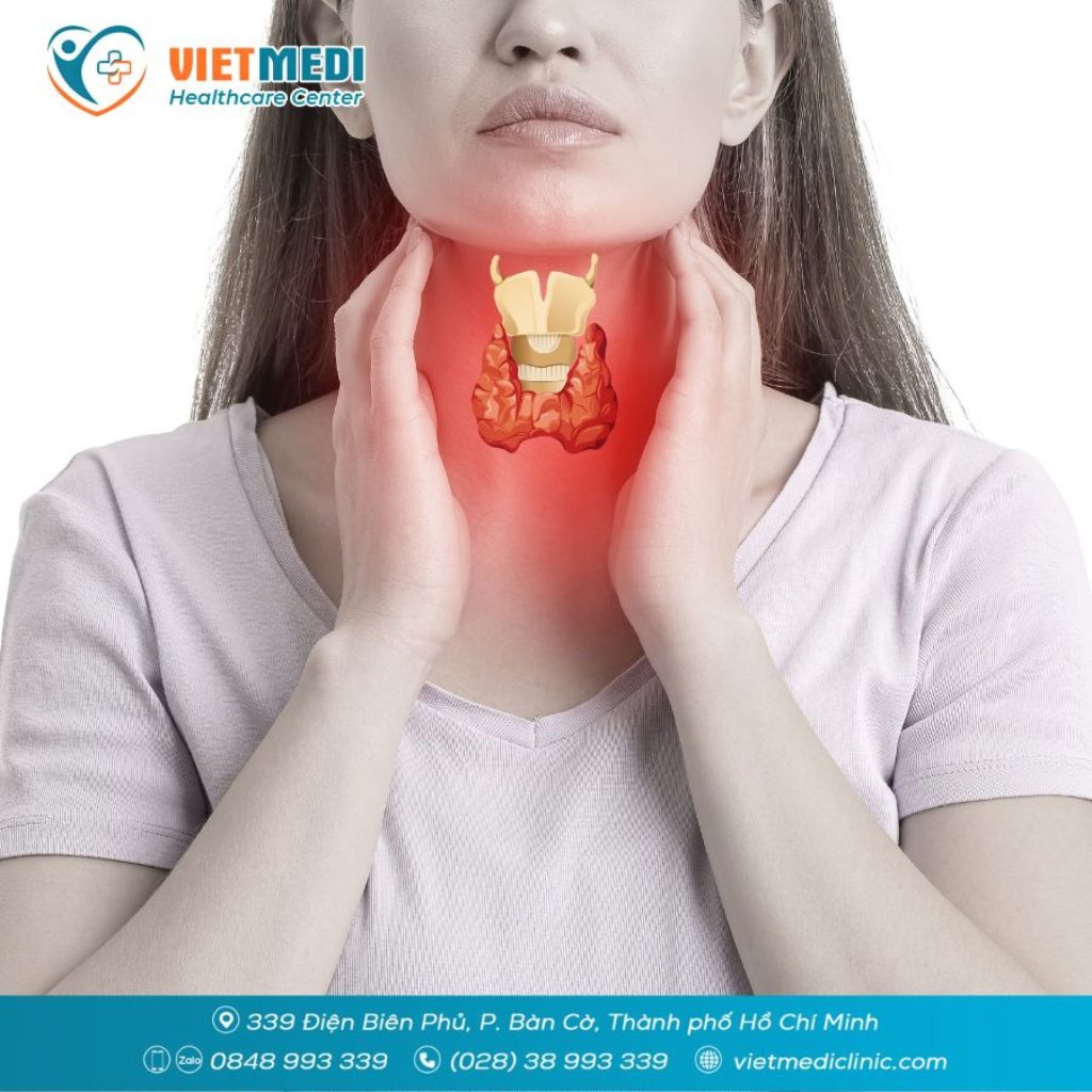 CẢNH BÁO BỆNH TUYẾN GIÁP: DẤU HIỆU, NGUYÊN NHÂN VÀ CÁCH KIỂM SOÁT HIỆU QUẢ